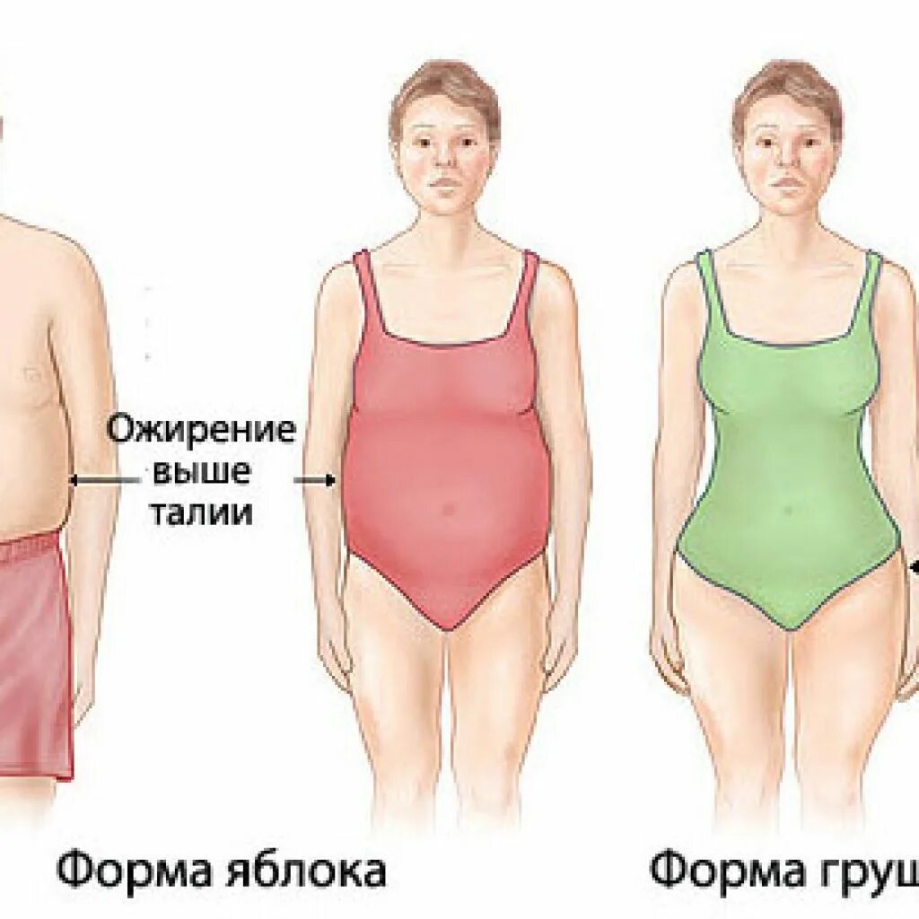Щитовидная полнота