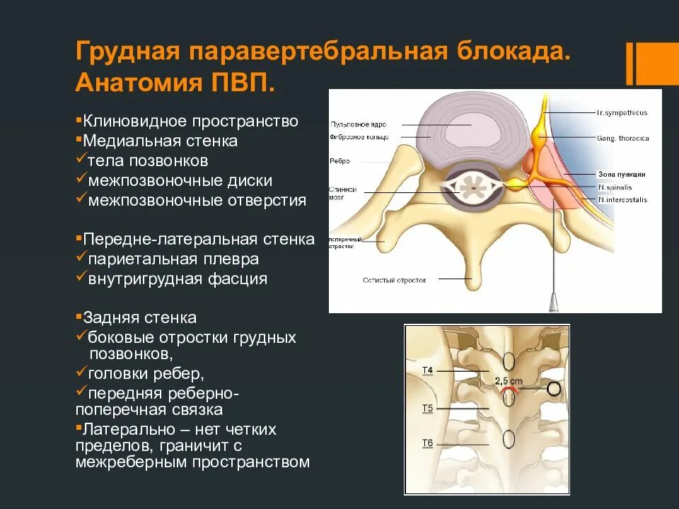 Паравертебральная блокада. Параверьебралтная блокпдп. Паравертрбрал блакада. Паравертебральная блокада поясничного отдела позвоночника.