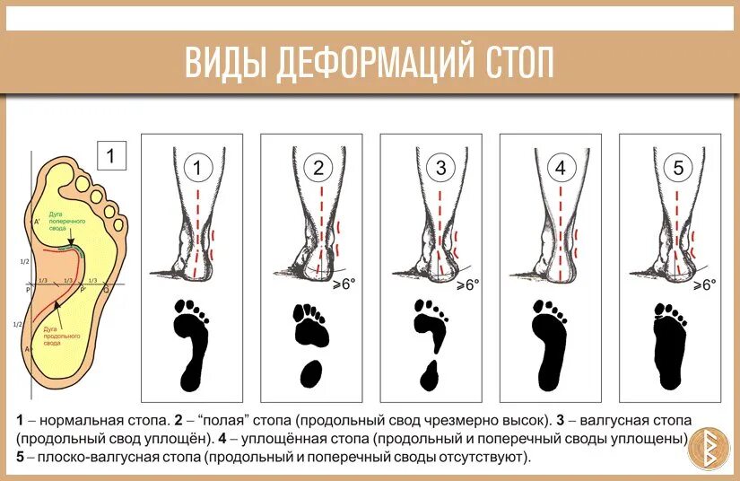 Направил свои стопы