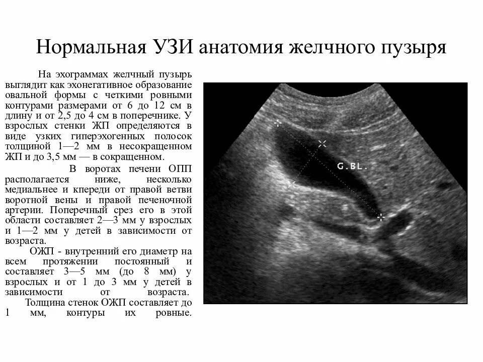 Узи желчного пузыря подготовка к процедуре. Узи анатомия желчного пузыря. методика узи желчного пузыря. узи желчного пузыря нормальные показатели. анатомия мочевого пузыря на узи.