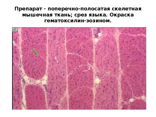 Поперечнополосатые мышечные волокна скелетной мышцы гистология. Скелетная мышечная ткань гистология препарат. Поперечнополосатая мышца гистология. Поперечно полосатая Скелетная мышечная ткань гистология препарат. Препарат поперечно полосатая мышечная ткань