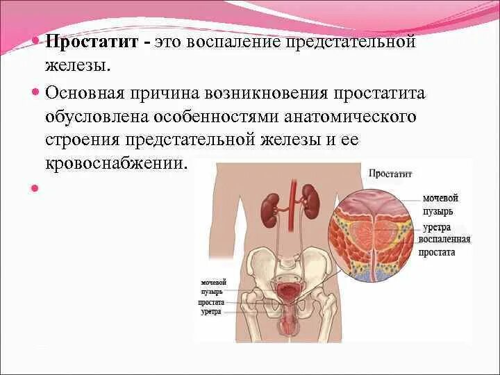 Воспалить простату. Кровоснабжение предстательной железы.