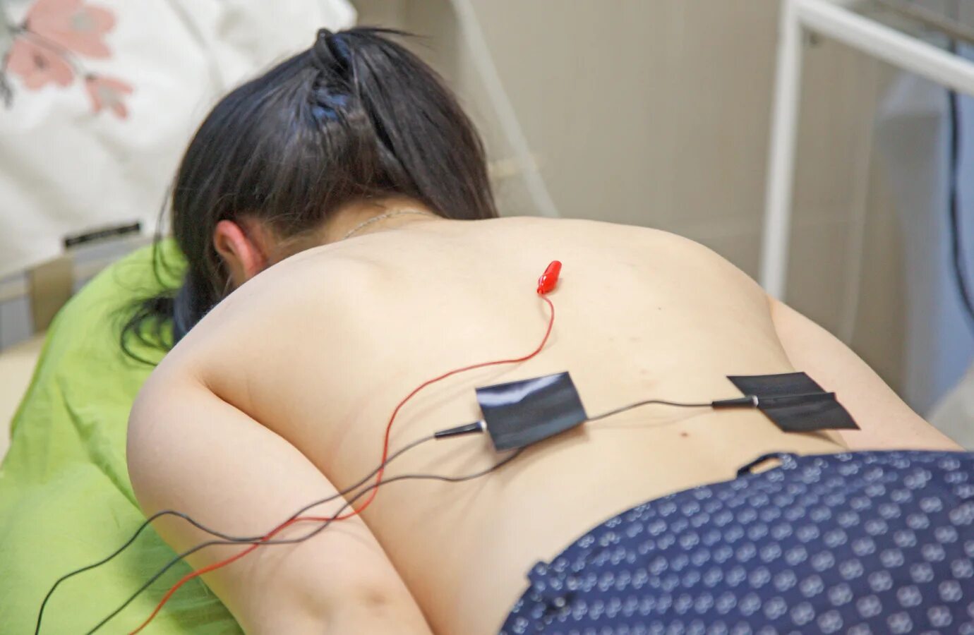 Втэс по герасимову. Метод герасимова внутритканевая. Аппарат втэс герасимова. Электростимуляция позвоночника по методу герасимова. Внутритканевая электростимуляция сустава.