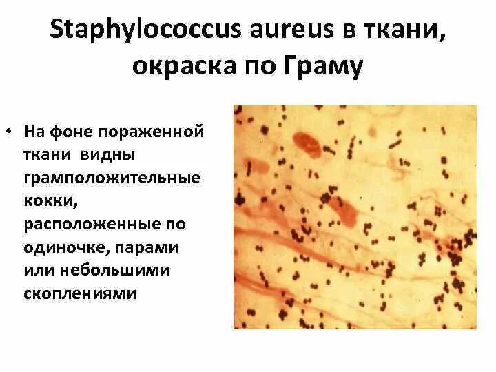 Стафилококки окраска. Staphylococcus aureus окраска по граму. стафилококки окраска по грамму.