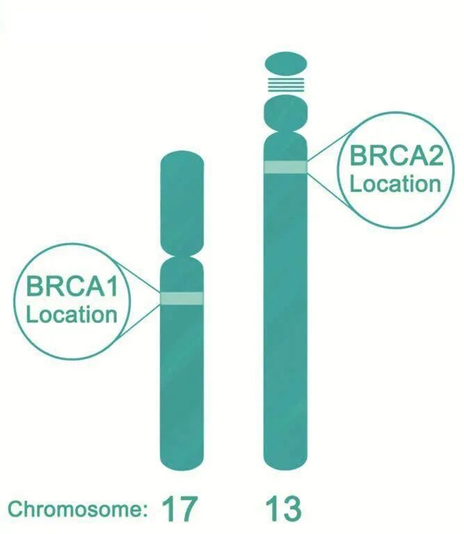 Мутация гена brca 2. Гены brca1 и brca2. brca мутации. мутация генов brca1 и brca2. brca ген.