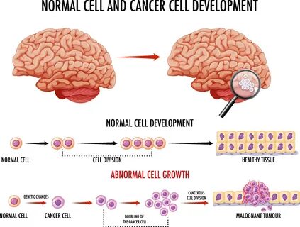 Download Diagram showing normal and cancer cells in human for free.