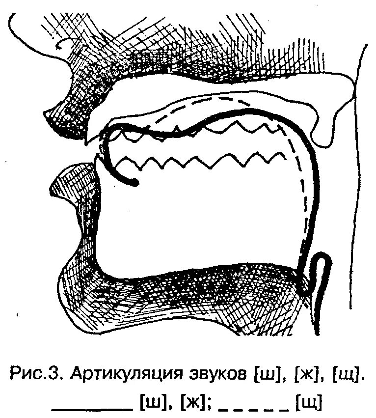 Артикуляция зубов. Профили свистящих звуков при ринолалии. Межзубный сигматизм звука ж. Артикуляция звука с. Постановка межзубного звука с.