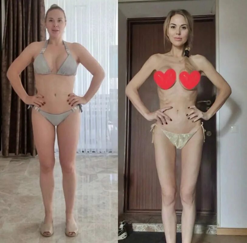 Выглядит болезненно. Голова больше туловища!": Мася Шпак напугала видом после ре