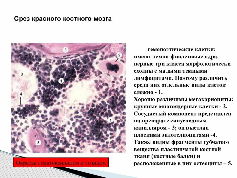 Структуры красного костного мозга. Красный костный мозг строение. Срез красного костного мозга гистология. Срез красного костного мозга (в препарате Кортиев орган). Миелоидная ткань красного костного мозга.