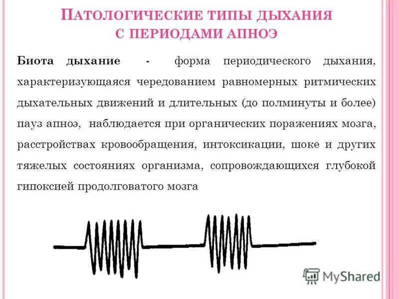 периоды дыхания