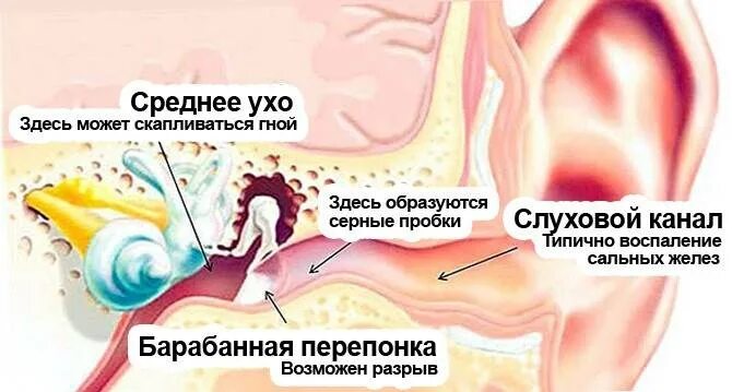 Больно закладывает уши. Чтотделатл если болит ухо.