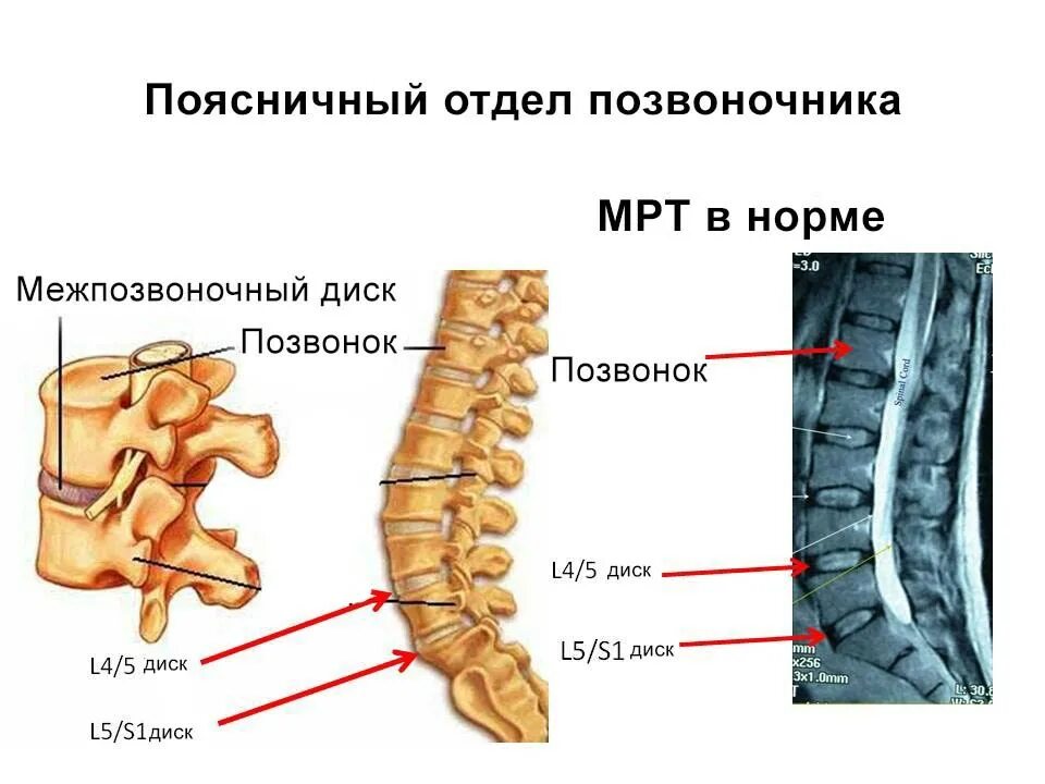 Позвонки пояснично-крестцового отдела позвоночника. Строение позвоночника пояснично крестцовый отдел позвоночника. Телах l1, l2 позвонков. L1 l2 позвонка поясничного отдела. Органы крестцового отдела