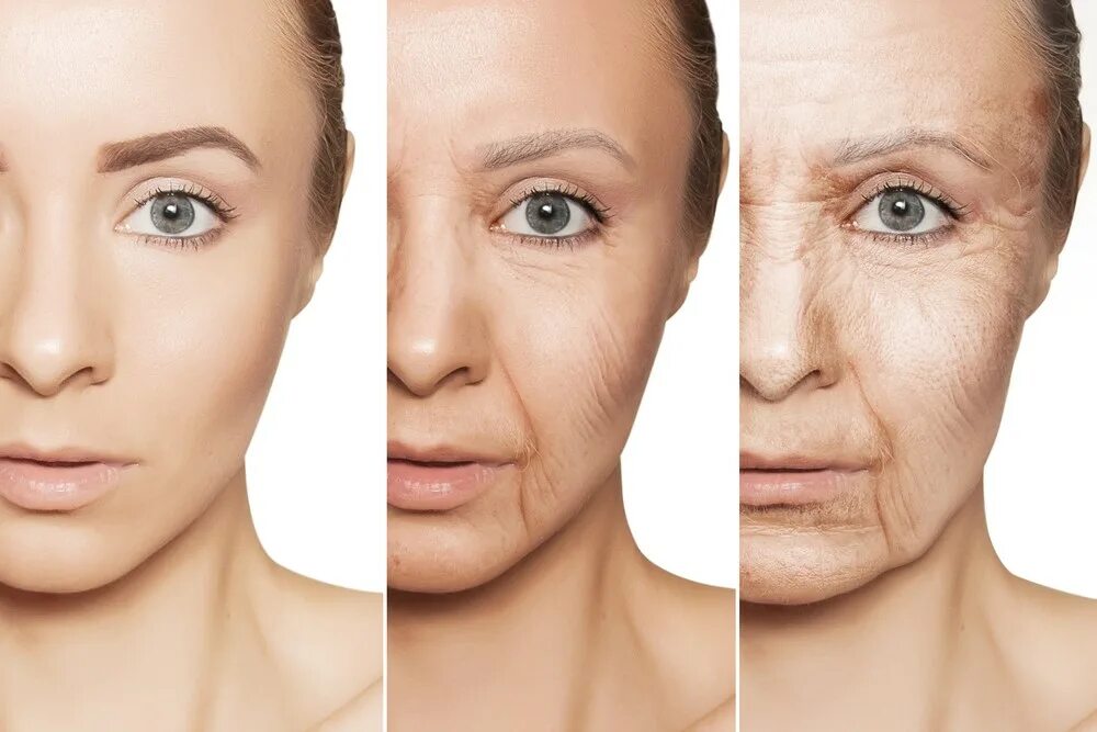 Старение лица. Возрастные морщины. Старение кожи. Старение кожи лица. Skin wrinkles