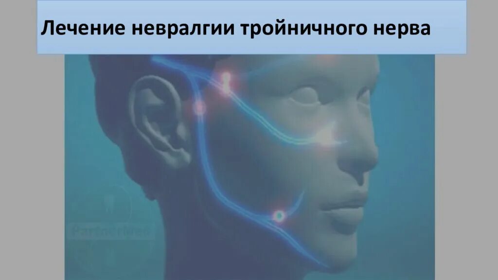 Лечение тройничного нерва после. Терапия невралгии тройничного нерва. Невралгия тройничного нерва неврология. Тригеминальная невралгия тройничного нерва. Тройничный нерв таблетки.