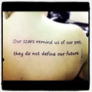 Scars i am they