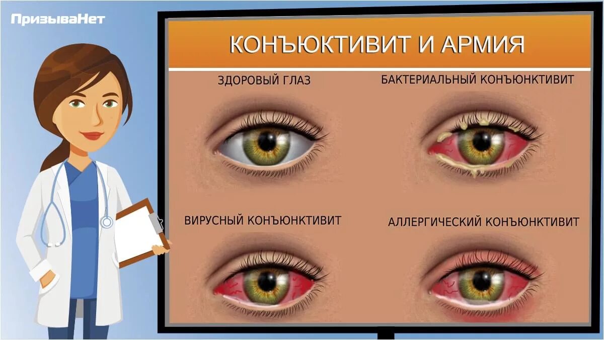 Психосоматика веко. Конъюнктивит у взрослых симптомы. конъюнктивит психосоматика. острый вирусный конъюнктивит.