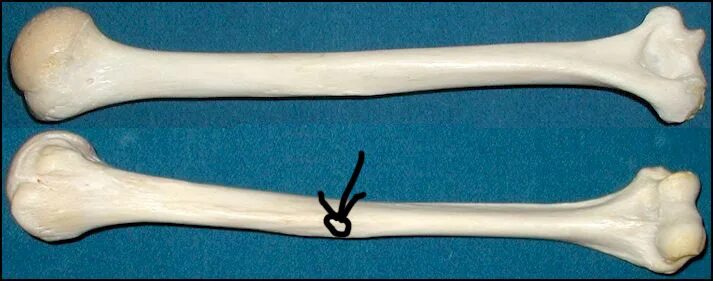 Bone lab. Bone defects humerus.