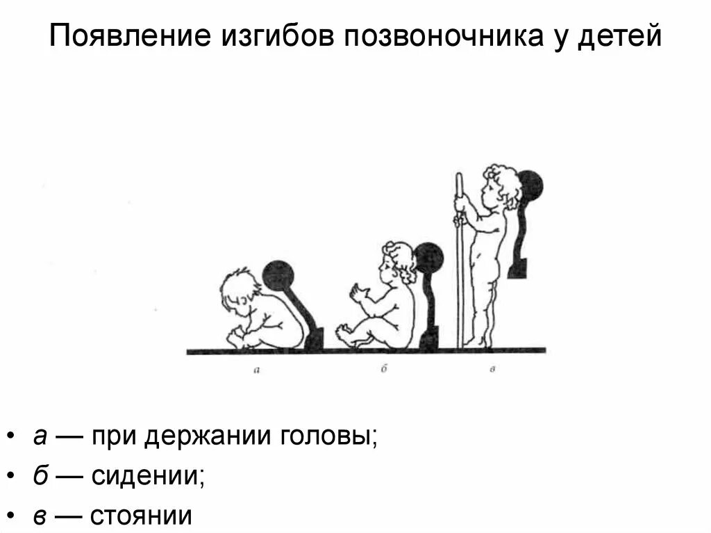 Появление изгибов позвоночника. Формирование физиологических изгибов позвоночника у детей. Появление изгибов позвоночника у детей. Формирование изгибов позвоночника у ребенка сроки. Изгибы позвоночника у детей