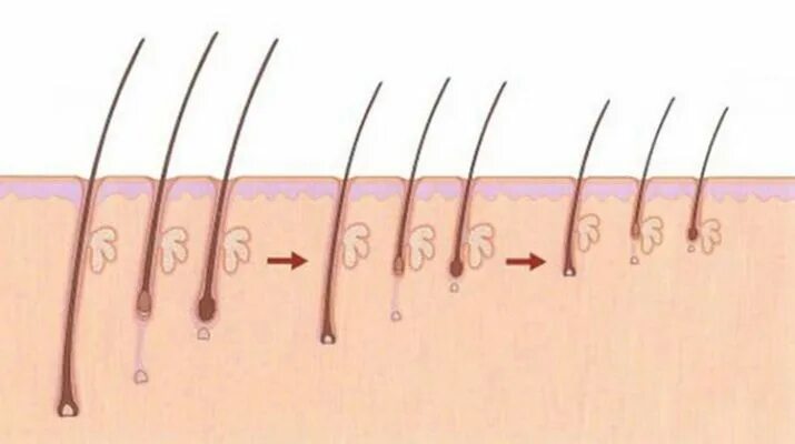 Растут корни волос. Алопеция волосяной фолликул. Андрогенная алопеция фолликул. Волосяная луковица. Волос с волосяной луковицей.