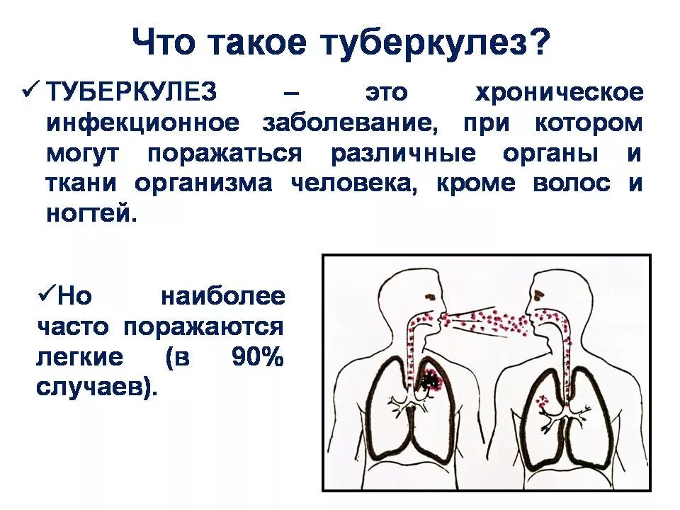 Как называли туберкулез