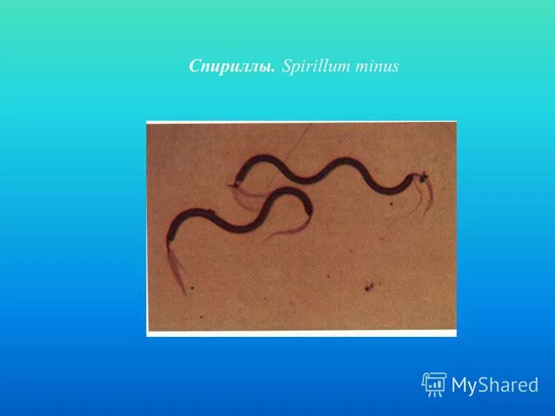 вибрионы и спириллы. спиралевидные спириллы бактерии. спиралевидные спириллы. бациллы, спириллы, вибрионы, кокки.