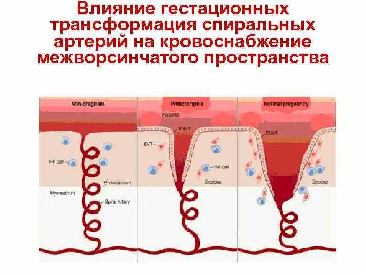 Эндометрия сосудов. Спиральные маточные артерии. Спиральные артерии матки. Инвазия трофобласта в спиральные артерии. Гестационная трансформация спиральных артерий.