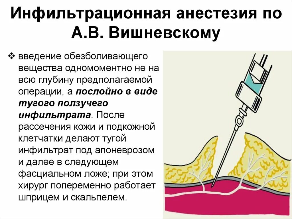 Инфильтрационная послойная анестезия. Местная проводниковая инфильтрационная анестезия. Инфильтрационная анестезия лидокаином методика. Местная инфильтрационная анестезия методика. Что такое проводниковая анестезия