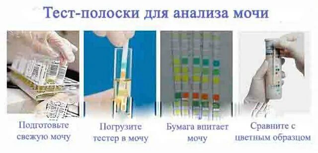Тест полоски для определения белка в моче. Измерение белка в моче. тест полоски на белок в моче. определение белка в моче экспресс методом. экспресс тест на белок в моче.