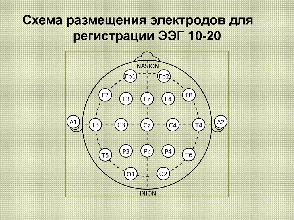 Ээг 10 10. Схема 10-20 наложение электродов. ЭЭГ наложение электродов схема 10-20. Схема расположения электродов 10-20 ЭЭГ. Электроэнцефалография схема 10 20.