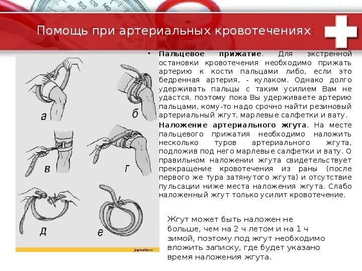 Максимальное наложение артериального жгута. Схема наложение жгута при кровотечении. Максимальное наложение жгута при артериальном кровотечении. Наложение жгута для остановки кровотечения.