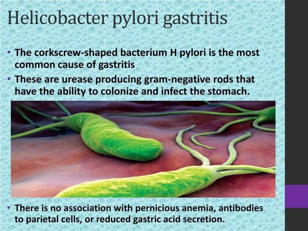 Диагностика инфекции Helicobacter pylori. Желудочная бактерия хеликобактер. Инфицированность Helicobacter pylori. Бактерия хеликобактер пилори симптомы. Причины появления хеликобактер в желудке