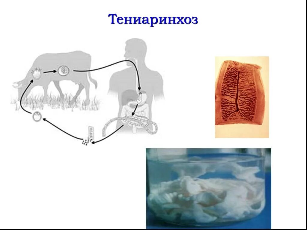 Симптомы цепня у человека. Тениоз (свиной цепень), тениаринхоз (бычий цепень).. Тениаринхоз бычий цепень. Тениаринхоз пути заражения. Тениаринхоз антропоноз.