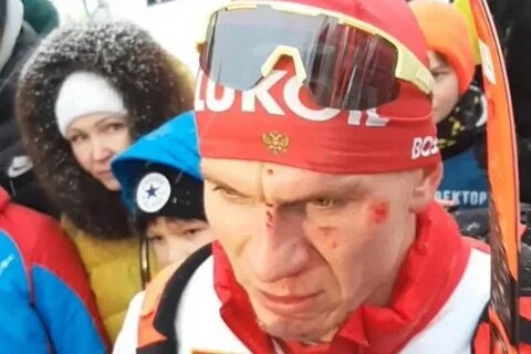Что случилось на лыжной трассе