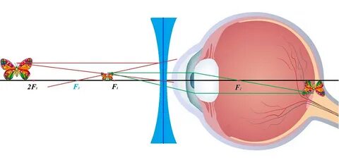 Optical can force the eyes to see