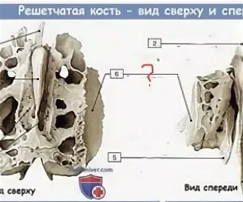 Решетчатая кость функции. Решетчатая кость анатомия строение. клиновидная и решетчатая кость. решетчатая кость вид сверху и спереди. решетчатая кость медунивер.