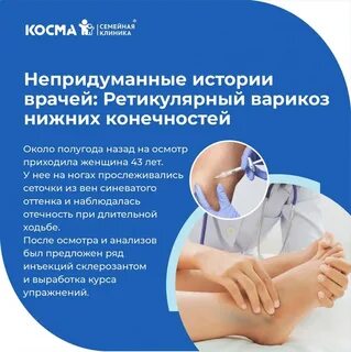 Отеки ног мкб