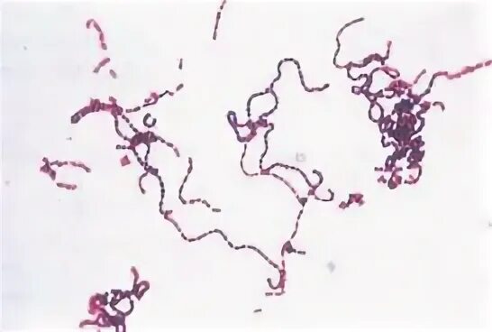 Пептококки морфология. Пептококки и пептострептококки микробиология. Peptostreptococcus anaerobius 1862. Анаэробные пептострептококки.