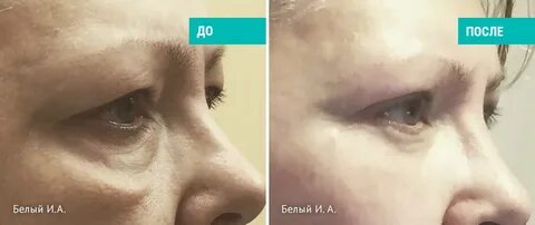 Белый пластический