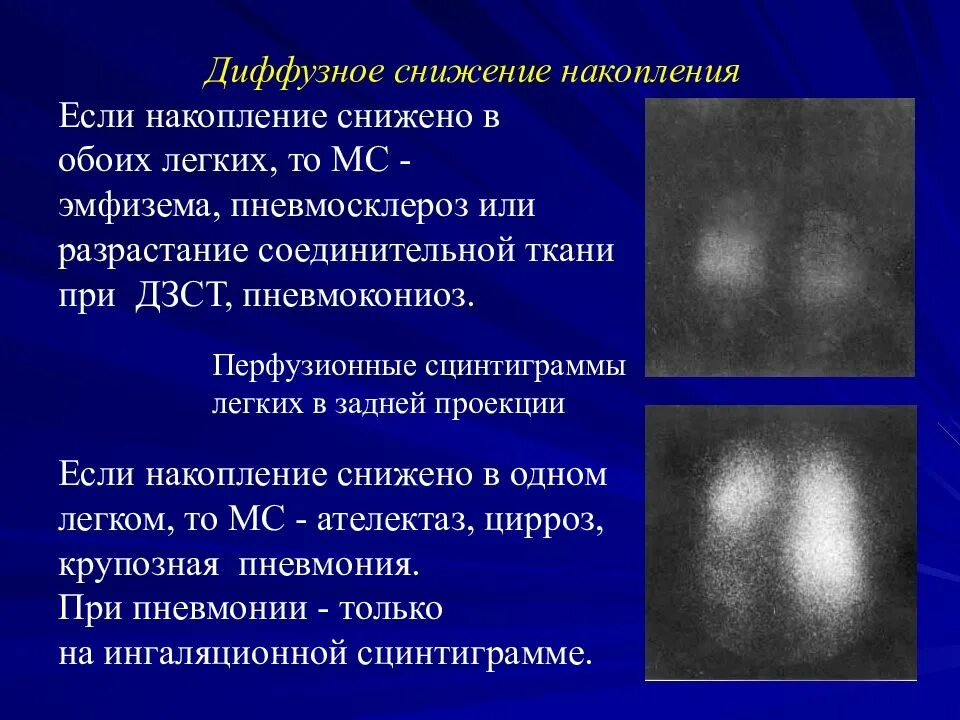 Декортикационная и децеребрационная ригидность. Диф диагностика синдрома вялого ребенка. Гипертонус мышц новорожденного. Диффузная мышечная гипотония у детей. Гипотонус мышц у грудничков.