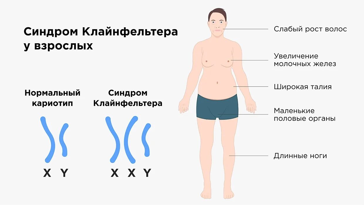 Нарушение формирования пола как выглядит
