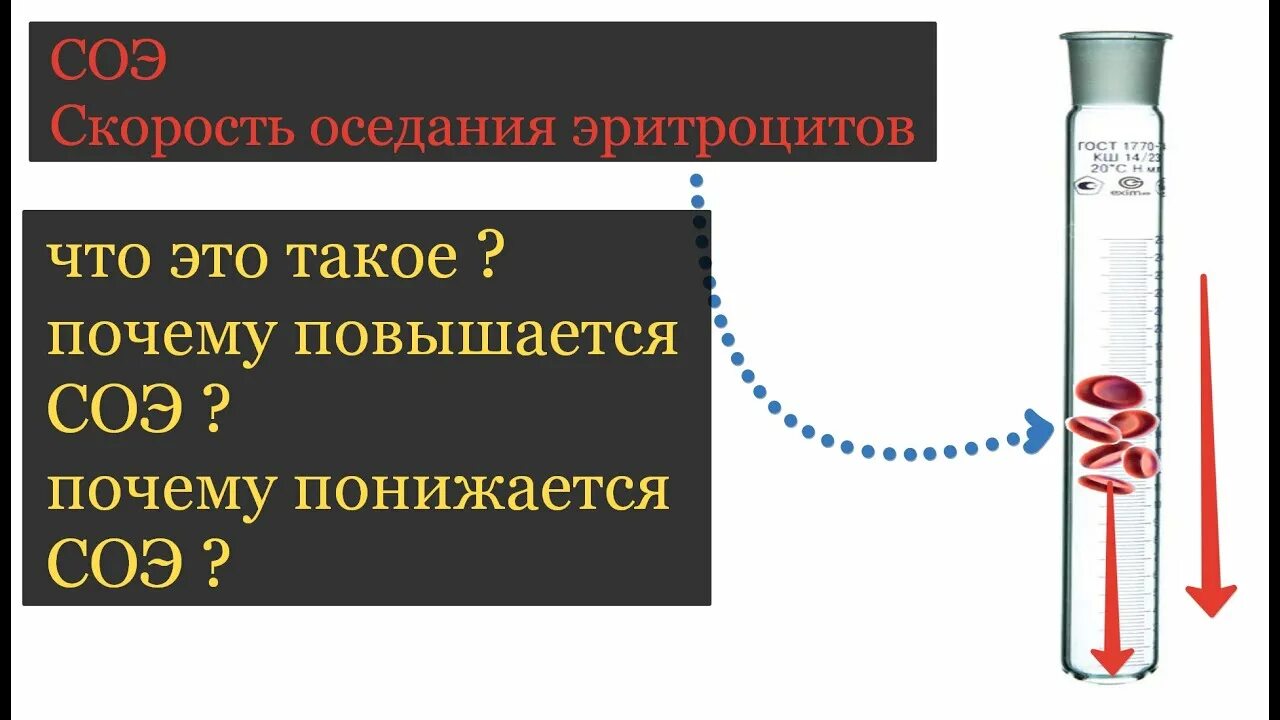 Скорость реакции оседания эритроцитов норма. Скорость оседания эритроцитов СОЭ норма. Скорость оседания эритроц. Скорость оседания эритроцитов по Панченкову.