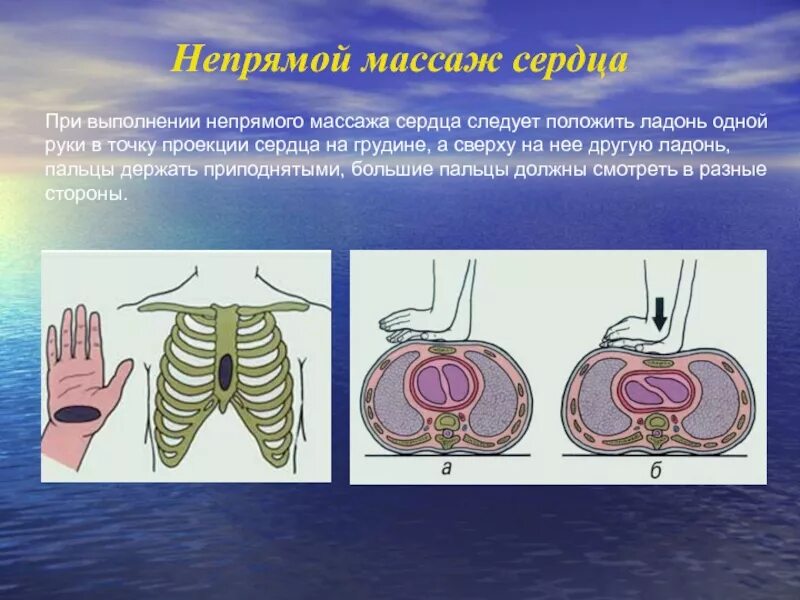 Ошибки при непрямом массаже сердца. Ошибки при проведении непрямого массажа сердца. типичные ошибки при проведении непрямого массажа сердца. ошибки при проведении ytghzvjuj vfccf;f c. возможные ошибки и осложнения при непрямом массаже сердца.