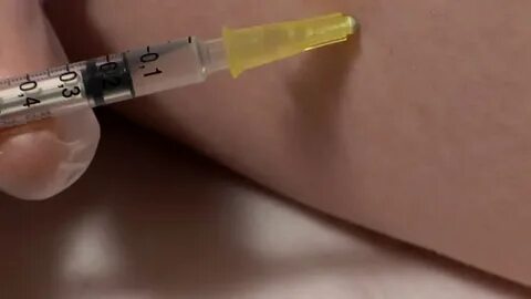 Хронотрон уколы в суставы отзывы врачей