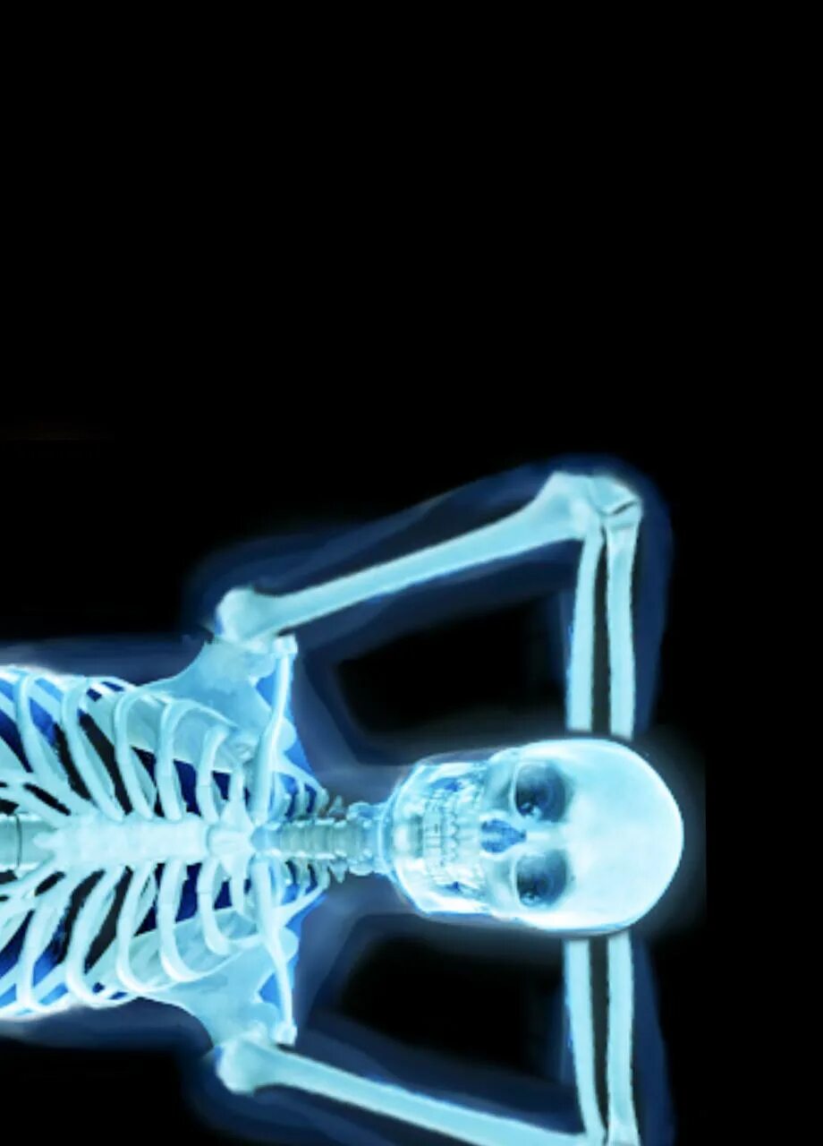 X ray scan. X ray scanner. рентген проверить на себе. проверить рентген телефоном.