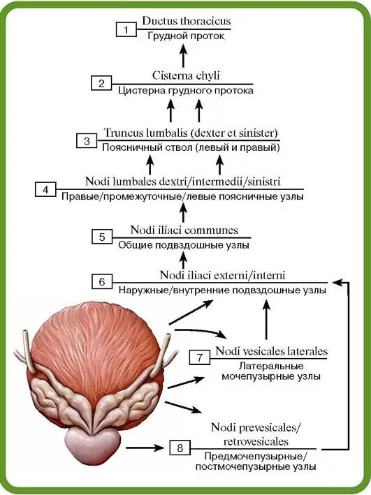 Узел в простате. Лимфатическая система мочевого пузыря. Региональные лимфатические узлы мочевого пузыря. Лимфоотток от мочевого пузыря. Региональные лимфатические узлы предстательной железы.