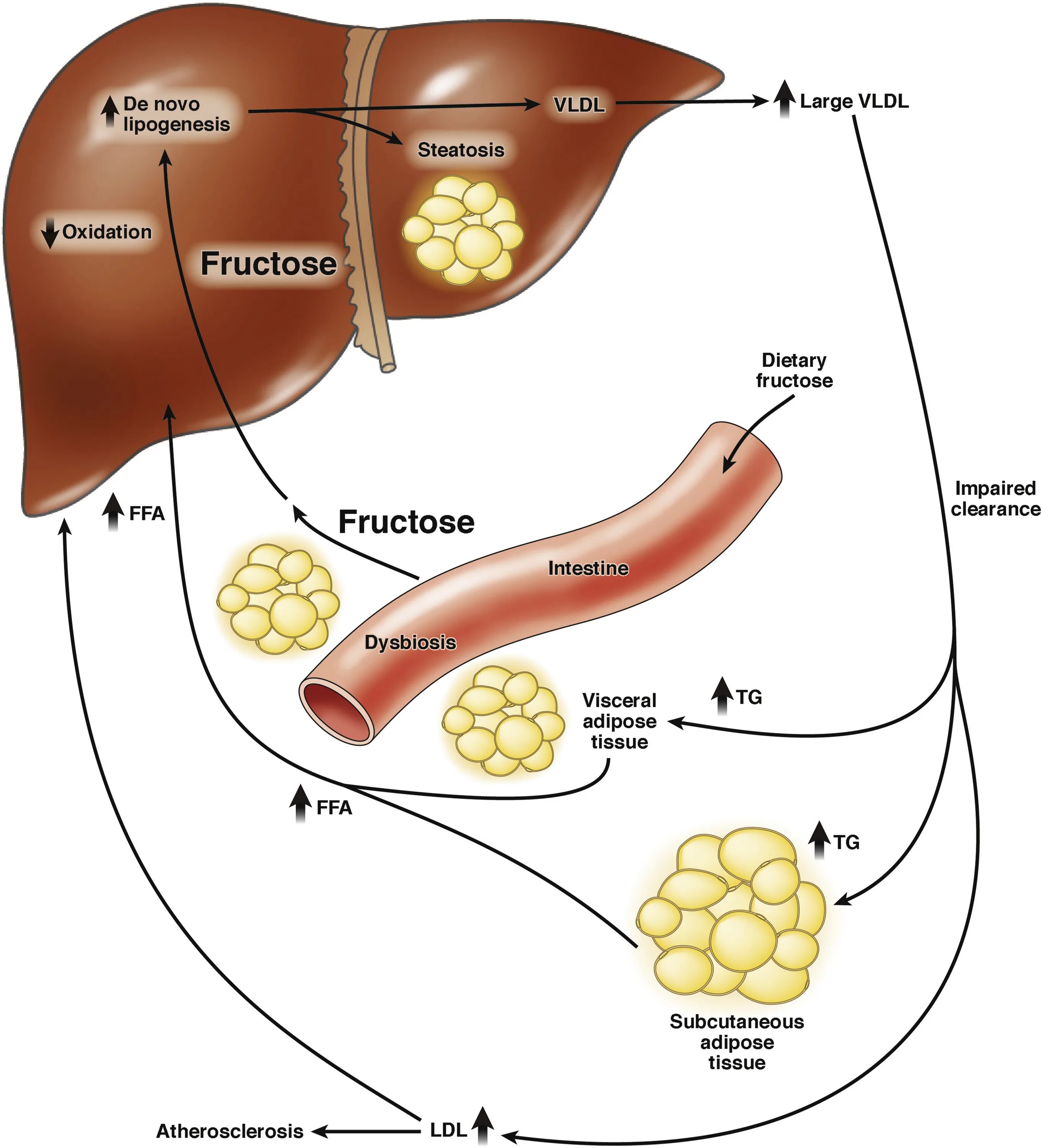 Превращения фруктозы в печени. Фруктоза в печени превращается. Липогенез схема. Фруктоза и печень