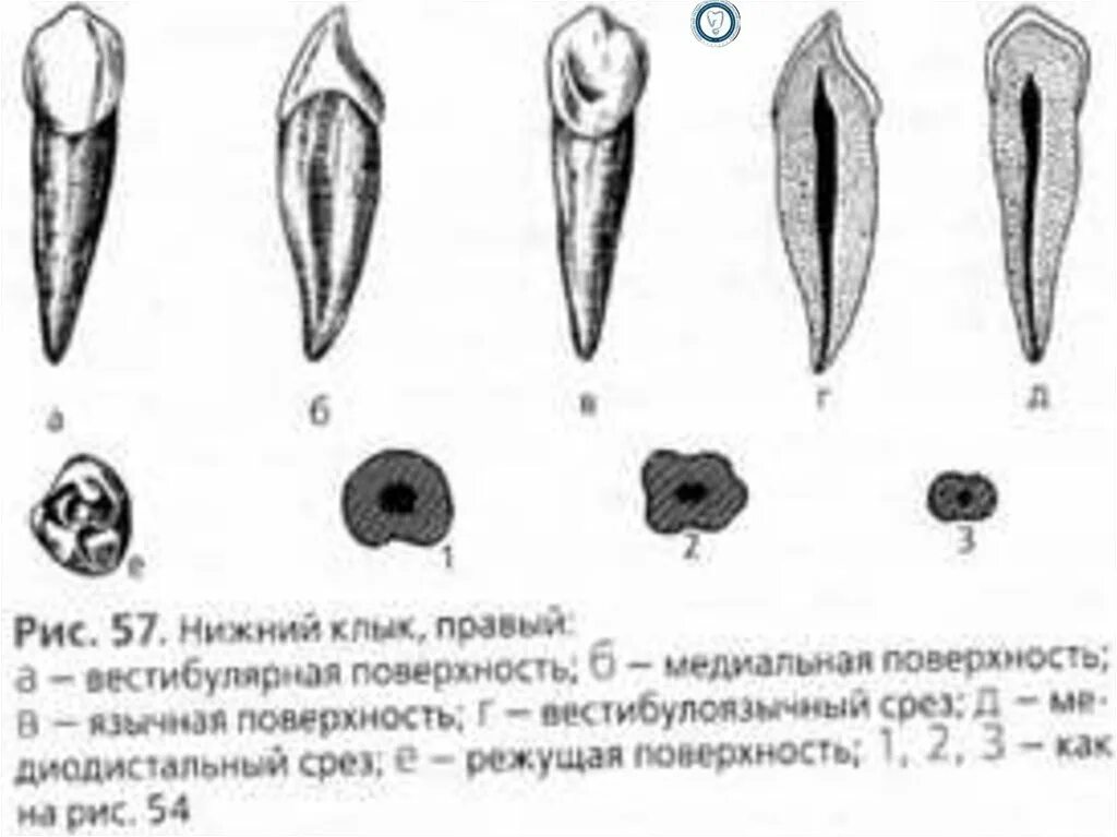 Клык сверху зубов. Клык верхней челюсти анатомия. Верхний медиальный резец анатомия. Верхний клык вестибулярная поверхность. Нижний медиальный резец анатомия.