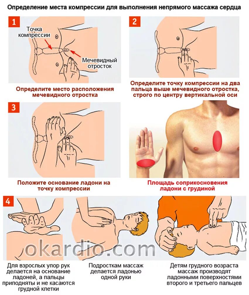 Непрямой массаж сердца техника выполнения. Правильное исполнение непрямого массажа сердца. Точка на теле для проведения непрямого массажа сердца располагается:. Как выполняется непрямой массаж сердца. Сжатие груди