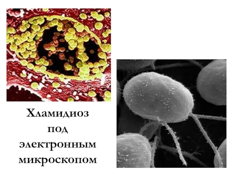 Хламидия chlamydia. Хламидии электронная микроскопия. Хламидия трахоматис микроскопия. Хламидии форма бактерии.