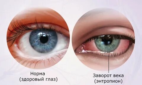 Признаки век